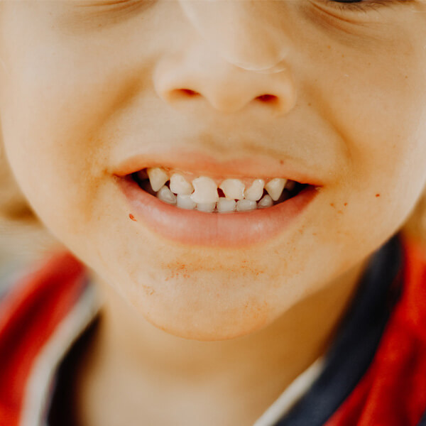 Children's Teeth